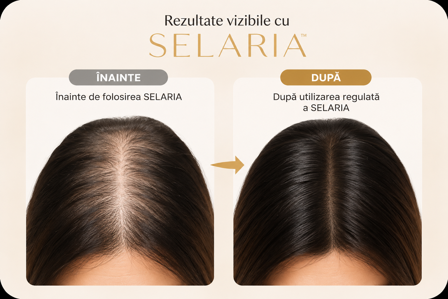 Înainte și după SELARIA